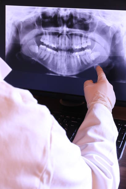 Best Emergency Dentist for Knocked-Out Tooth in Doolittle, TX